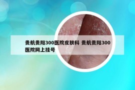 貴航貴陽300醫(yī)院皮膚科 貴航貴陽300醫(yī)院網(wǎng)上掛號