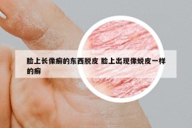 臉上長像癬的東西脫皮 臉上出現(xiàn)像蛻皮一樣的癬