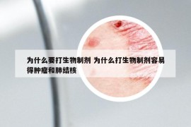 為什么要打生物制劑 為什么打生物制劑容易得腫瘤和肺結(jié)核