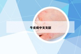 牛皮癬中文文獻
