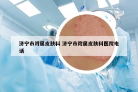 濟(jì)寧市附屬皮膚科 濟(jì)寧市附屬皮膚科醫(yī)院電話