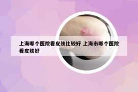上海哪個(gè)醫(yī)院看皮膚比較好 上海市哪個(gè)醫(yī)院看皮膚好