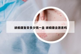 頑癬康復(fù)膏多少錢一盒 頑癬康含激素嗎