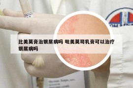比美莫膏治銀屑病嗎 吡美莫司乳膏可以治療銀屑病嗎