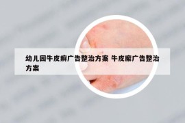 幼兒園牛皮癬廣告整治方案 牛皮廨廣告整治方案