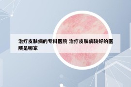 治療皮膚病的?？漆t(yī)院 治療皮膚病較好的醫(yī)院是哪家