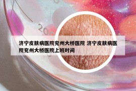 濟(jì)寧皮膚病醫(yī)院兗州大橋醫(yī)院 濟(jì)寧皮膚病醫(yī)院兗州大橋醫(yī)院上班時(shí)間