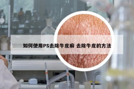如何使用PS去除牛皮癬 去除牛皮的方法