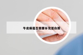 牛皮癬是否需要補充蛋白質