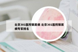 北京301醫(yī)院銀屑病 北京301醫(yī)院銀屑病專家排名