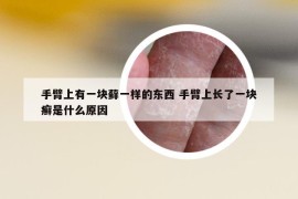 手臂上有一塊蘚一樣的東西 手臂上長了一塊癬是什么原因