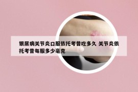 銀屑病關(guān)節(jié)炎口服依托考昔吃多久 關(guān)節(jié)炎依托考昔每服多少毫克