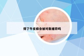 得了牛皮癬會被對象嫌棄嗎