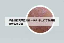 手指接打完風(fēng)壁針有一塊白 手上打了封閉針為什么有白斑