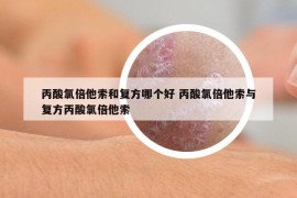 丙酸氯倍他索和復(fù)方哪個(gè)好 丙酸氯倍他索與復(fù)方丙酸氯倍他索