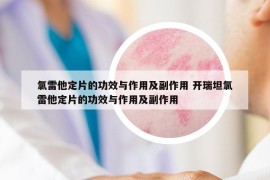 氯雷他定片的功效與作用及副作用 開瑞坦氯雷他定片的功效與作用及副作用