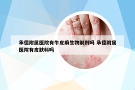 承德附屬醫(yī)院有牛皮癬生物制劑嗎 承德附屬醫(yī)院有皮膚科嗎