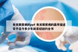 有關銀屑病的ppt 有關銀屑病的最早描述見于迄今多少年前圣經(jīng)舊約全書