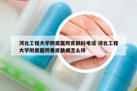 河北工程大學(xué)附屬醫(yī)院皮膚科電話 河北工程大學(xué)附屬醫(yī)院看皮膚病怎么樣