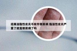 結(jié)果溢脂性皮炎不除外銀屑病 脂溢性皮炎嚴(yán)重了就是銀屑病了嗎