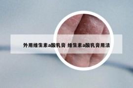 外用維生素a酸乳膏 維生素a酸乳膏用法