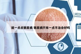 就一點(diǎn)點(diǎn)銀屑病 銀屑病只有一點(diǎn)不治會(huì)好嗎