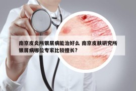 南京皮炎所銀屑病能治好么 南京皮膚研究所銀屑病哪位專家比較擅長(zhǎng)?