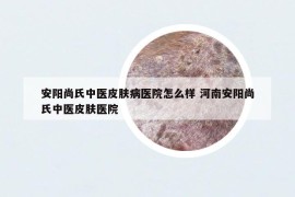 安陽(yáng)尚氏中醫(yī)皮膚病醫(yī)院怎么樣 河南安陽(yáng)尚氏中醫(yī)皮膚醫(yī)院