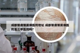 成都銀康銀屑病醫(yī)院地址 成都銀康銀屑病醫(yī)院是三甲醫(yī)院嗎?