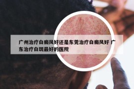 廣州治療白癜風(fēng)好還是東莞治療白癜風(fēng)好 廣東治療白斑最好的醫(yī)院