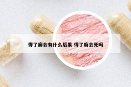 得了癬會(huì)有什么后果 得了癬會(huì)死嗎