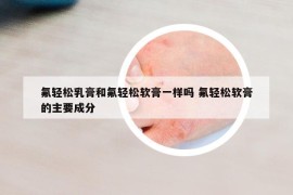 氟輕松乳膏和氟輕松軟膏一樣嗎 氟輕松軟膏的主要成分