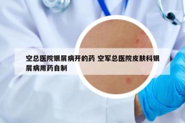 空總醫(yī)院銀屑病開的藥 空軍總醫(yī)院皮膚科銀屑病用藥自制