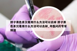 脖子黑色素沉著用什么方法可以去掉 脖子黑色素沉著用什么方法可以去掉_尋醫(yī)問藥專家頻道