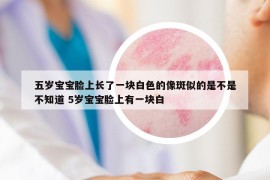 五歲寶寶臉上長(zhǎng)了一塊白色的像斑似的是不是不知道 5歲寶寶臉上有一塊白