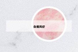 白癜風(fēng)蝦