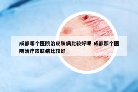 成都哪個醫(yī)院治皮膚病比較好呢 成都那個醫(yī)院治療皮膚病比較好