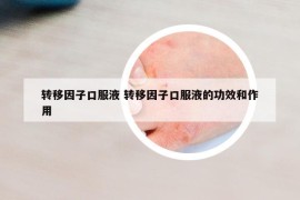 轉移因子口服液 轉移因子口服液的功效和作用