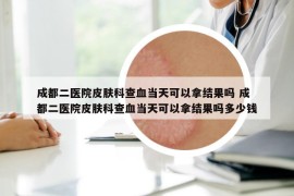 成都二醫(yī)院皮膚科查血當(dāng)天可以拿結(jié)果嗎 成都二醫(yī)院皮膚科查血當(dāng)天可以拿結(jié)果嗎多少錢(qián)