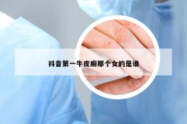 抖音第一牛皮癬那個(gè)女的是誰(shuí)
