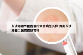 長沙湘雅二醫(yī)院治療銀屑病怎么樣 湖南長沙湘雅二醫(yī)院皮膚?？? /></a>		
		</figure>

		<header class=