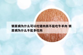 銀屑病為什么可以吃豬肉而不能吃牛羊肉 銀屑病為什么不能多吃肉