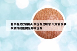 北京看皮膚病最好的醫(yī)院是哪家 北京看皮膚病最好的醫(yī)院是哪家醫(yī)院