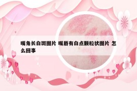 嘴角長白斑圖片 嘴唇有白點(diǎn)顆粒狀圖片 怎么回事