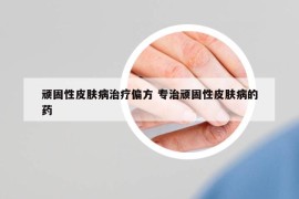 頑固性皮膚病治療偏方 專治頑固性皮膚病的藥